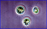 .    Haematococcus,   400 .